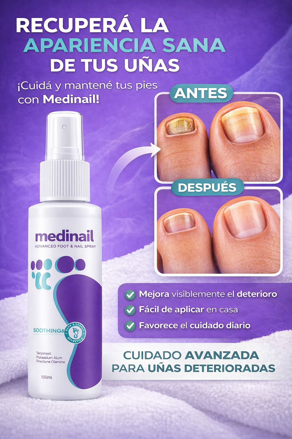MEDINAIL NAIL FUNGUS spray