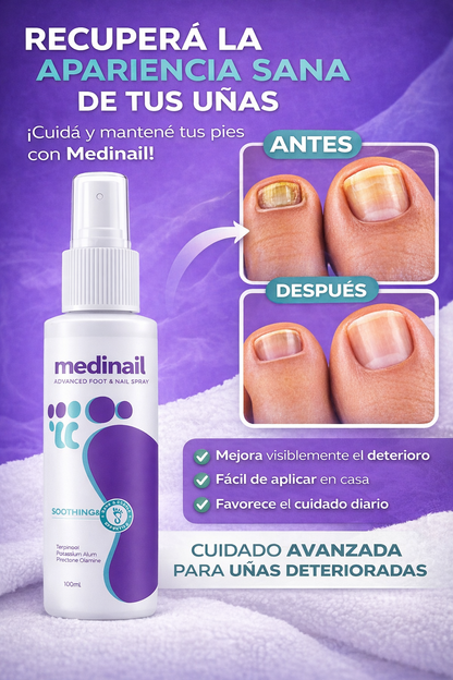 MEDINAIL NAIL FUNGUS spray